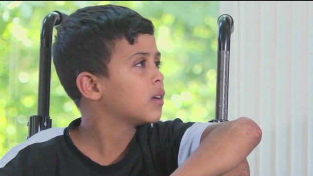Boy from Gaza comes to Atlanta, begins treatment after losing legs in airstrike