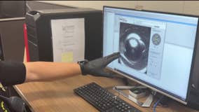 Brookhaven police use new technology to crack cases