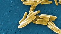 Tuberculosis case reported at Johns Creek school, families notified
