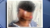 DeKalb County mother begs for answers after son hit while on skates