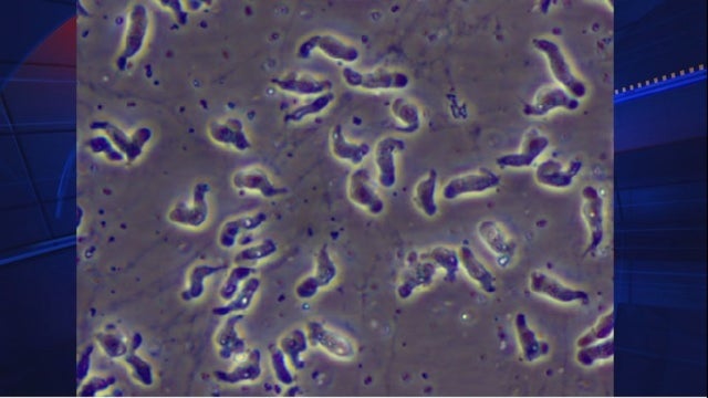 Swimmer dies after contracting rare brain-eating amoeba at NC water park