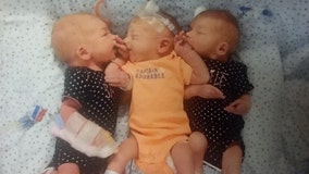 Woman who thought she was having kidney stone pain unexpectedly gives birth to triplets
