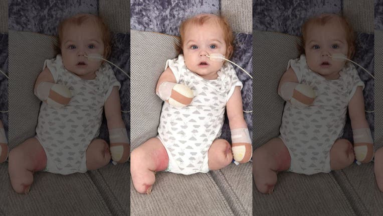 Oliver was released from the hospital in July.