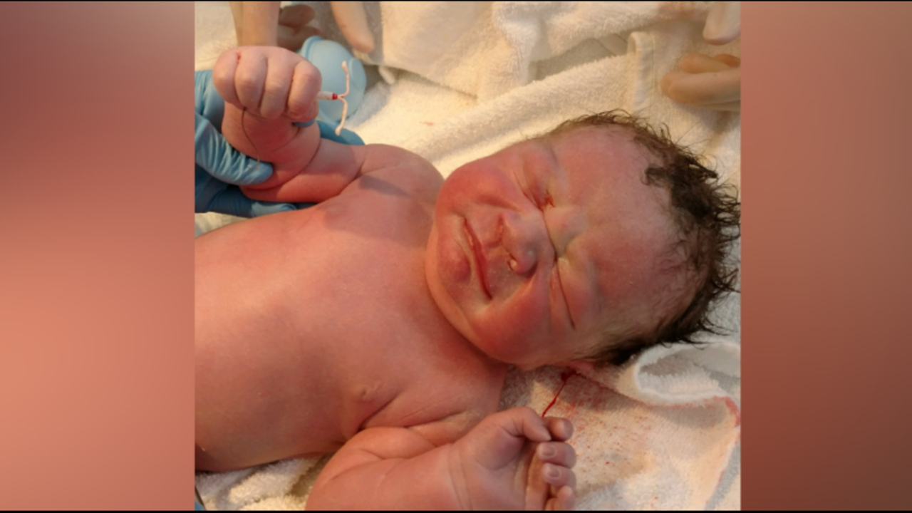 Viral photo shows baby holding mom's 'failed' IUD | FOX 5 DC