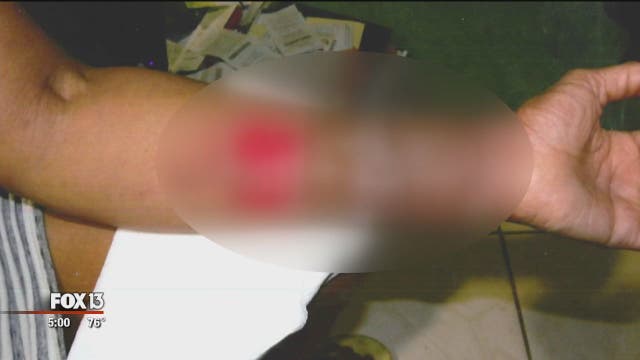 Tampa Army reservist claims injury by Nutribullet blender