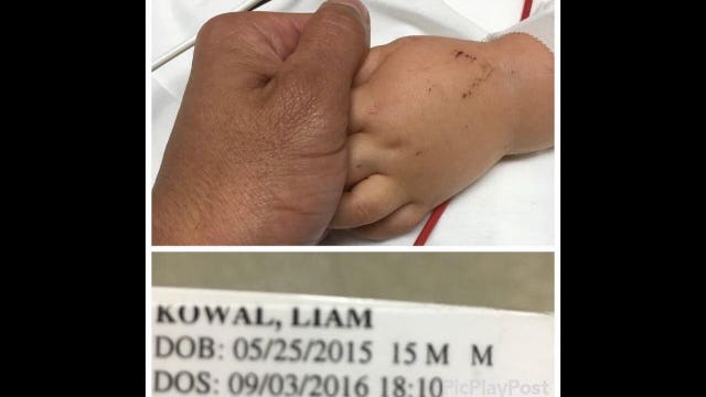 MMA fighter donates son's organs after baby killed by alleged drunk driver