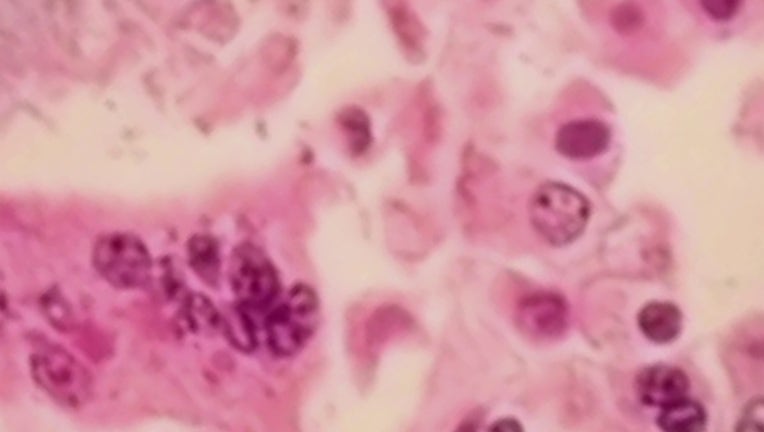 3e9e81ef-
