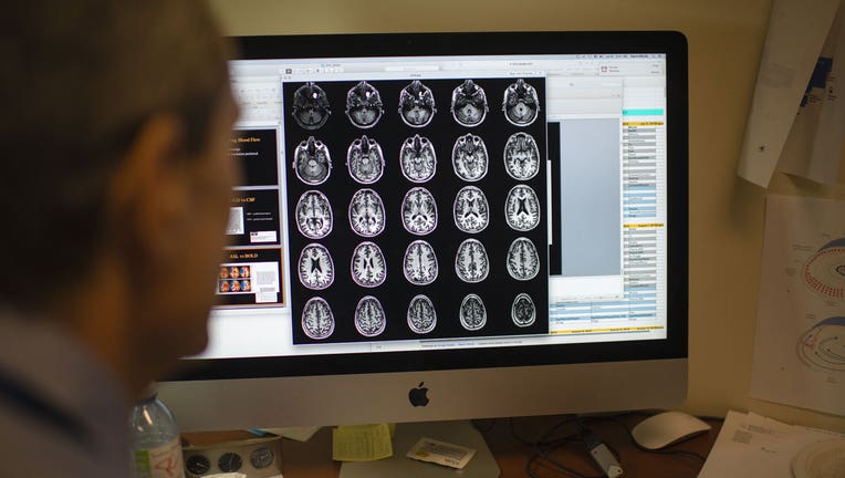 A doctor looks over multiple scans of a brain following an MRI. (Brian B. Bettencourt/Toronto Star via Getty Images)