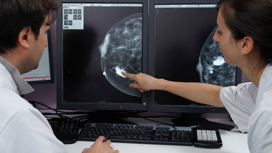 Doctors examine an x-ray of a breast tumor.
