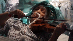 Patient plays violin during brain tumor removal