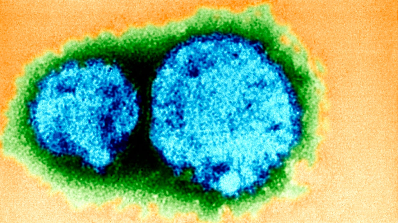 Maryland monitoring 2 residents for possible hantavirus exposure; what you need to know