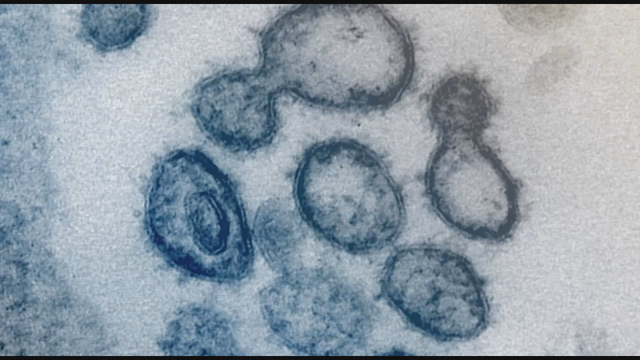 How to tell if it's allergies or coronavirus: Dr. Saphier weighs in