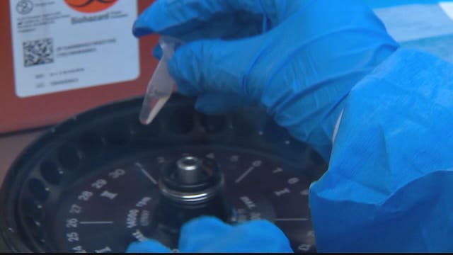 As number of confirmed coronavirus cases go up, so do concerns for testing kits in D.C region
