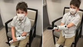 Illinois boy who lost parts from all 4 limbs gets ‘Star Wars’-themed multi-grip bionic ‘Hero Arm’