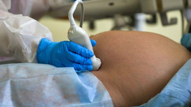 Pregnant women with coronavirus are 5 times more likely to be hospitalized, data from CDC shows