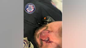 Police: Suspect in drug-related arrest bit officer's nose while trying to escape