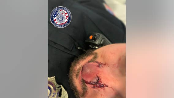 Police: Suspect in drug-related arrest bit officer's nose while trying to escape