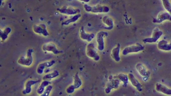 Rare brain-eating amoeba infection confirmed in Florida, health officials say