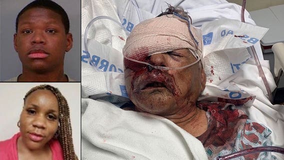 Authorities seek help locating suspects in alleged attack on 80-year-old at grocery store