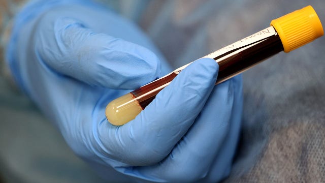 Large study finds coronavirus-fighting antibodies do not fade quickly, offering hope for virus vaccine efforts
