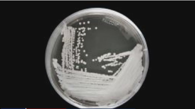 CDC: Untreatable 'superbug' outbreak discovered at DC nursing home