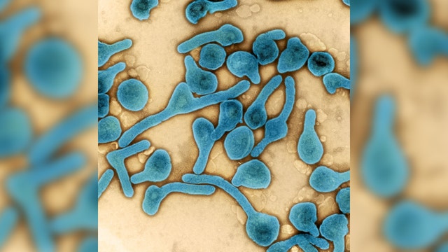 Marburg virus: Guinea reports first-ever case of deadly disease, WHO says