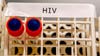 Spike in HIV, STI cases in Prince George's County spurs urgent action