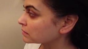 Fox 5’s Ayesha Khan shares a glimpse into her chemo treatment for breast cancer