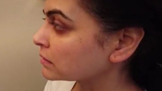 Fox 5’s Ayesha Khan shares a glimpse into her chemo treatment for breast cancer