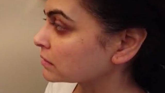 Fox 5’s Ayesha Khan shares a glimpse into her chemo treatment for breast cancer