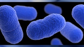 CDC: New listeria outbreak tied to 23 illnesses, 1 death