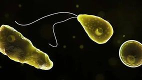 Deadly brain-eating amoeba found in Iowa beach as temperatures rise