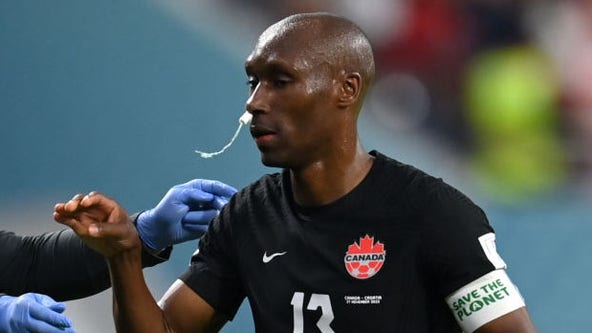 Canadian captain plays with tampon up nose during World Cup loss to Croatia