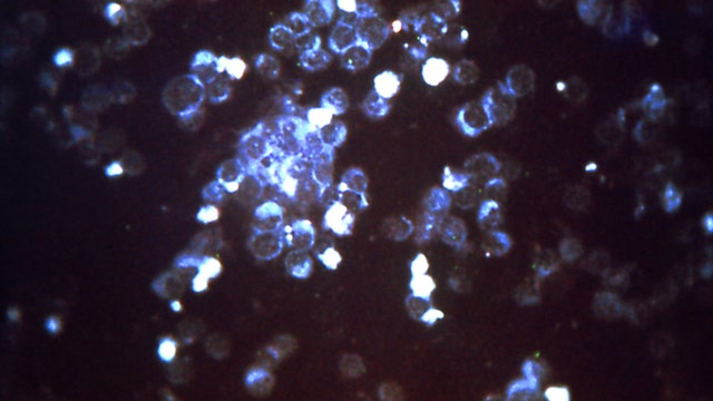 Maryland Department of Health launches RSV resource website