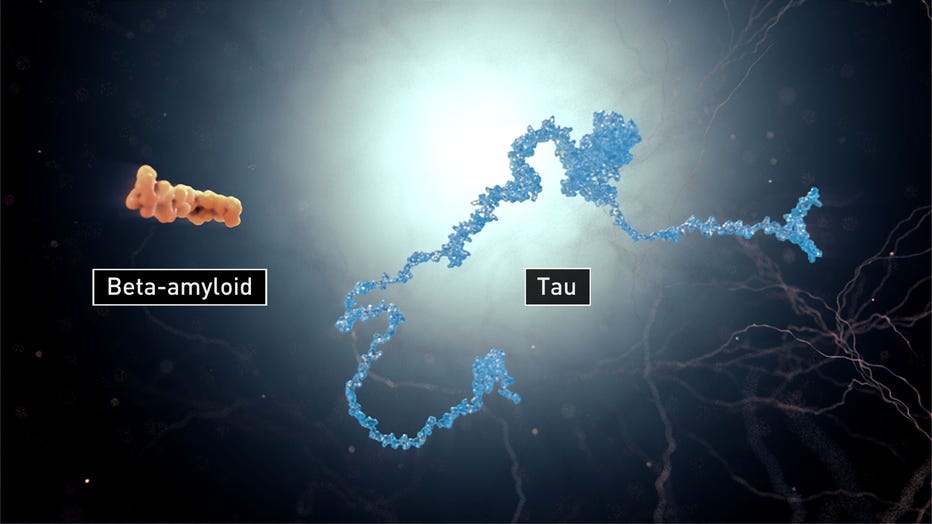 beta-amyloid-tau-copy.jpg