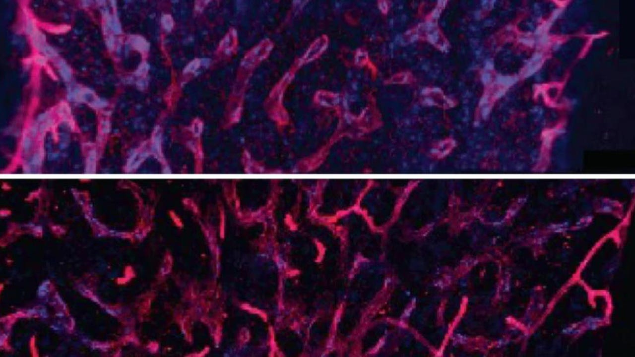 Revitalizing old blood with anti-inflammatory drug could slow aging, study suggests - Vimarsana News