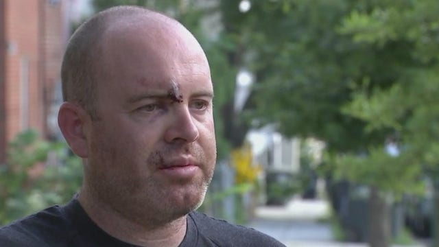 DC man brutally beaten on Anacostia Riverwalk Trail