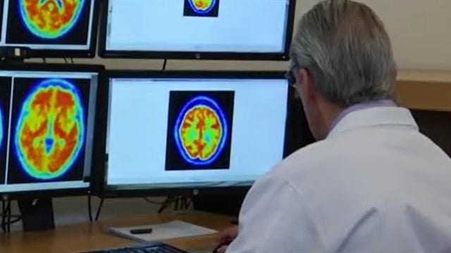 New Alzheimer's screening tools being tested in Maryland