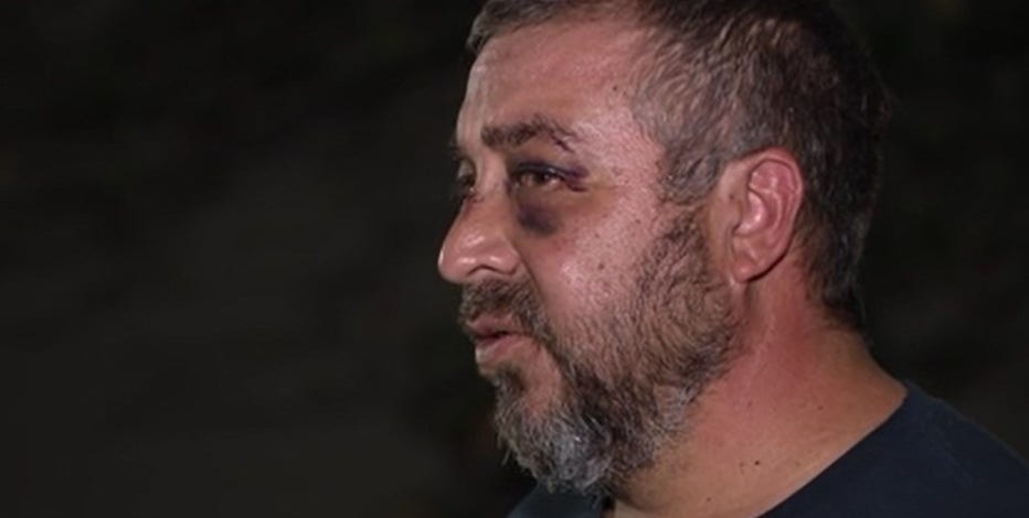 Parent attacks soccer coach with metal water bottle in Manassas