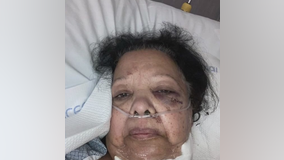 75-year-old speaks out from hospital bed after vicious stabbing at Temple Hills carry out