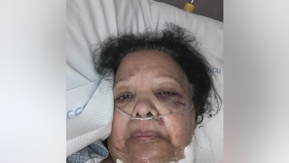 75-year-old speaks out from hospital bed after vicious stabbing at Temple Hills carry out