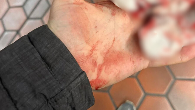 Metro rider claims he was sucker punched getting off train at Columbia Heights station