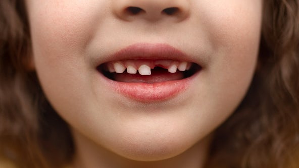 Tooth fairy payouts plummet 1st time in 5 years, dental poll finds