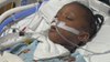 Parents frustrated with DC school after 6-year-old hospitalized for apparent allergic reaction