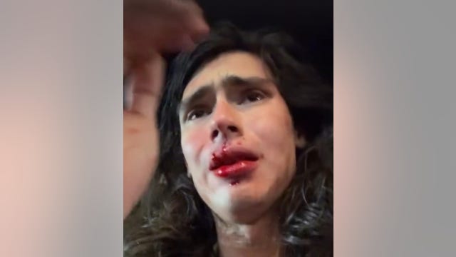 Teen arrested, more suspects sought in alleged hate crime against Colombian model