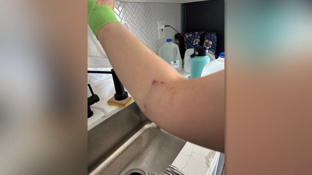 Lengthy police response time under investigation following Maryland dog attack