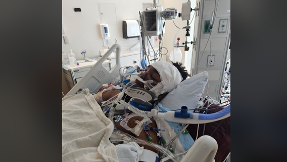 22-year-old in critical condition after hit-and-run