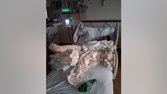 10-year-old injured by moped driver in Northwest DC hit-and-run, family says