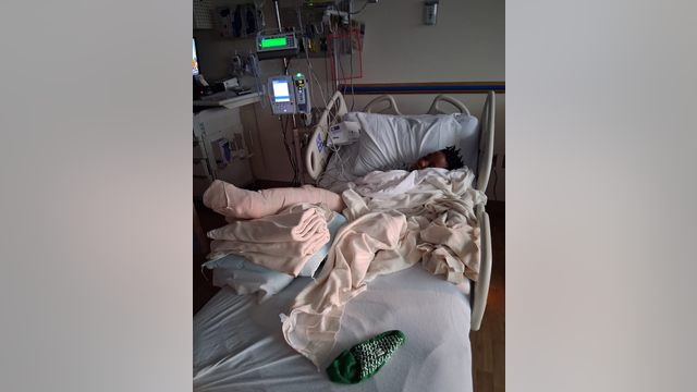 10-year-old injured by moped driver in Northwest DC hit-and-run, family says