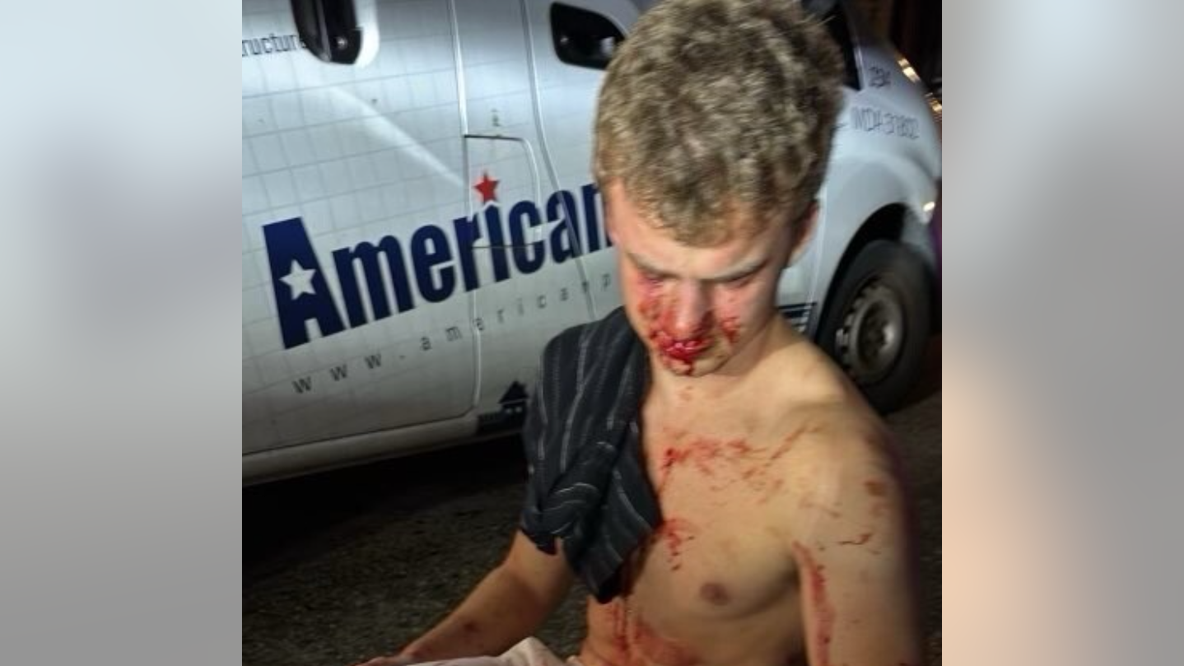 Who is 'Big Balls' Edward Coristine, the former DOGE employee beaten in DC?